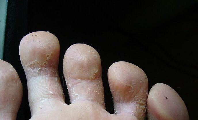 mantarın ilk aşaması